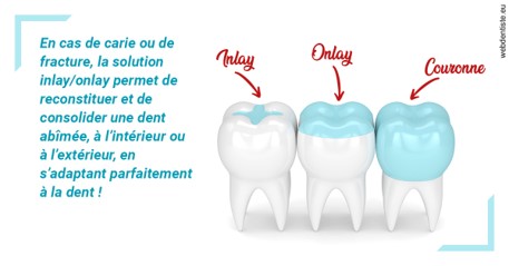 https://dr-yoanna-lumbroso-abtan.chirurgiens-dentistes.fr/L'INLAY ou l'ONLAY