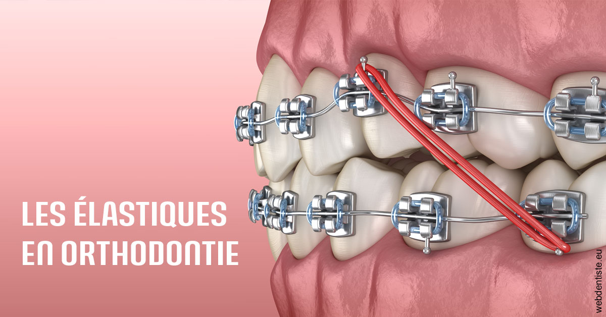 https://dr-yoanna-lumbroso-abtan.chirurgiens-dentistes.fr/Elastiques orthodontie 2