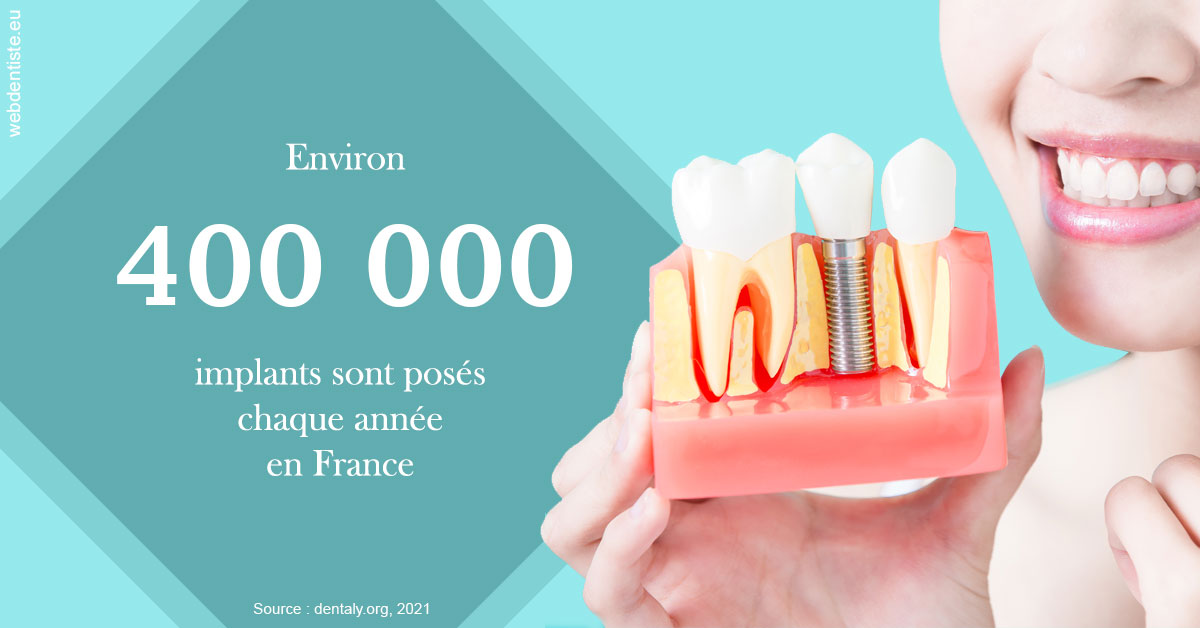 https://dr-yoanna-lumbroso-abtan.chirurgiens-dentistes.fr/Pose d'implants en France 2